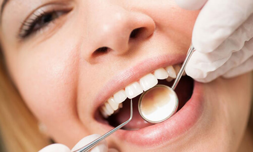 Picture of a dental cleaning procedure done by the Costa Rica Dental Center in San Jose, Costa Rica.  The picture shows a smiling woman having a dental cleaning.